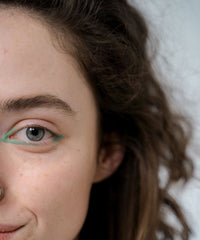 The Science Behind Acne - And How To Treat It