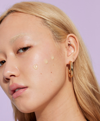 The Life Cycle of Pimples and How Get Rid of Them Faster